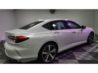 2025 Acura TLX