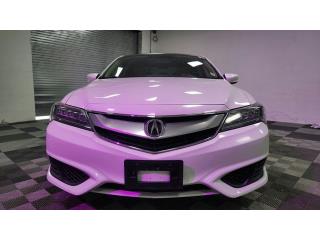 2017 Acura ILX
